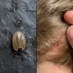 Small White Spots on Arms and Legs You Need To Know